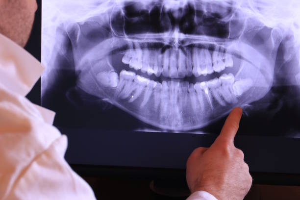Best Emergency Dentist for Knocked-Out Tooth in Auburn, AL